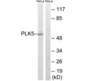 Western blot - PLK5 Antibody from Signalway Antibody (35024) - Antibodies.com