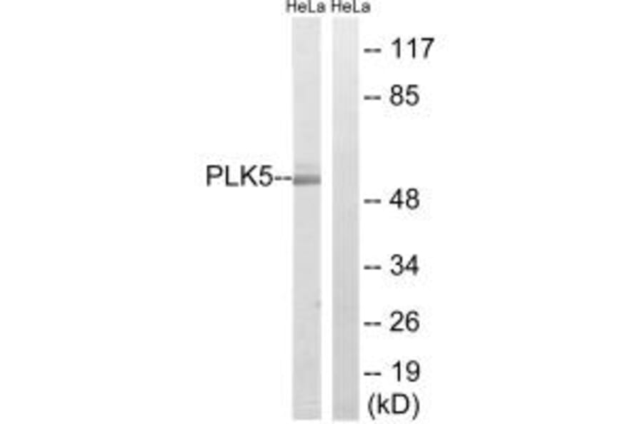 Western blot - PLK5 Antibody from Signalway Antibody (35024) - Antibodies.com