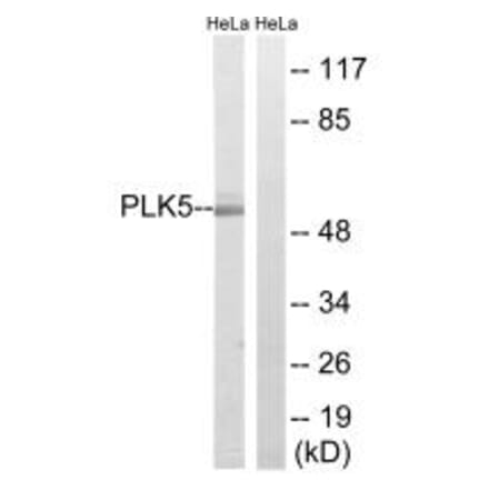 Western blot - PLK5 Antibody from Signalway Antibody (35024) - Antibodies.com