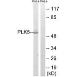 Western blot - PLK5 Antibody from Signalway Antibody (35024) - Antibodies.com