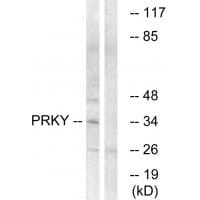 Western blot analysis of extracts from Jurkat cells, using PRKY antibody #35026.