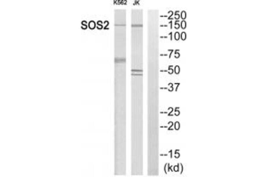 Western blot - SOS2 Antibody from Signalway Antibody (35069) - Antibodies.com
