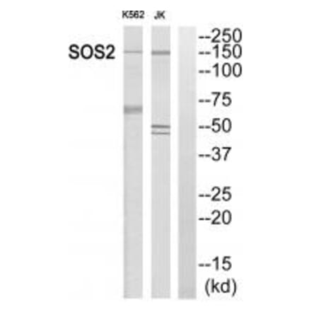 Western blot - SOS2 Antibody from Signalway Antibody (35069) - Antibodies.com