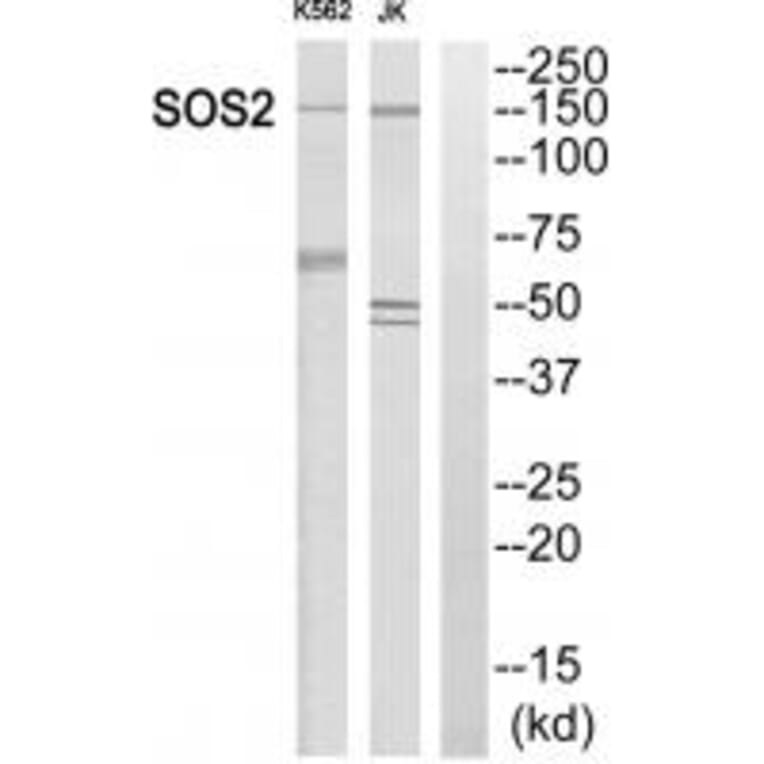 Western blot - SOS2 Antibody from Signalway Antibody (35069) - Antibodies.com