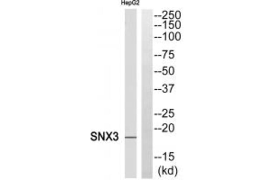 Western blot - SNX3 Antibody from Signalway Antibody (35070) - Antibodies.com