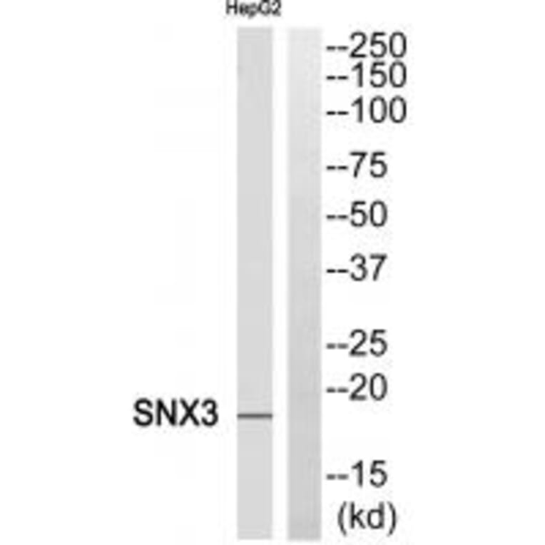 Western blot - SNX3 Antibody from Signalway Antibody (35070) - Antibodies.com