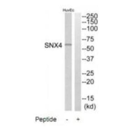 Western blot - SNX4 Antibody from Signalway Antibody (35071) - Antibodies.com