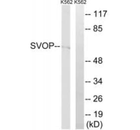 Western blot - SVOP Antibody from Signalway Antibody (35081) - Antibodies.com