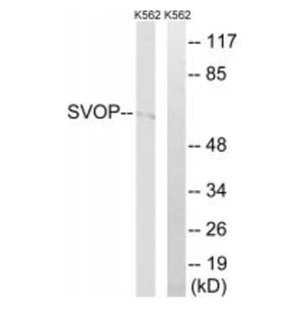 Western blot - SVOP Antibody from Signalway Antibody (35081) - Antibodies.com