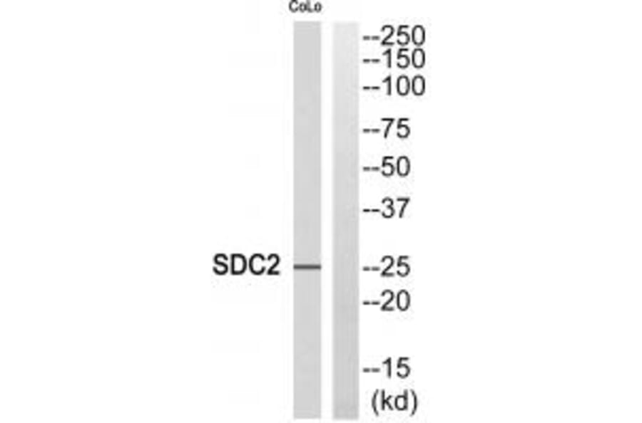 Western blot - SDC2 Antibody from Signalway Antibody (35086) - Antibodies.com
