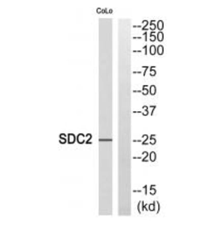 Western blot - SDC2 Antibody from Signalway Antibody (35086) - Antibodies.com