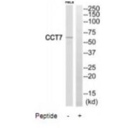 Western blot - CCT7 Antibody from Signalway Antibody (35091) - Antibodies.com