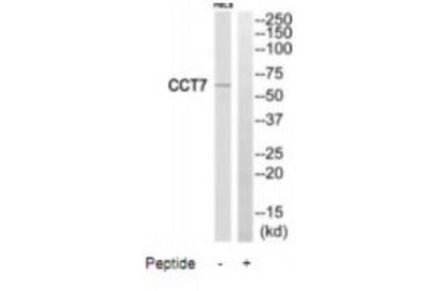 Western blot - CCT7 Antibody from Signalway Antibody (35091) - Antibodies.com