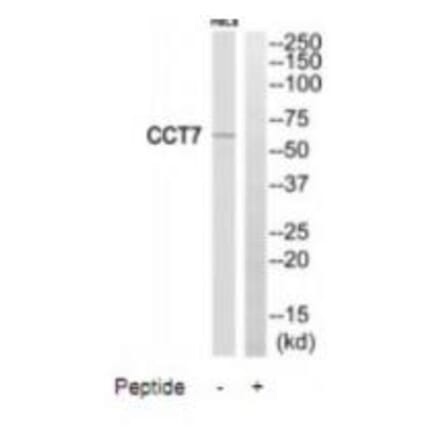 Western blot - CCT7 Antibody from Signalway Antibody (35091) - Antibodies.com