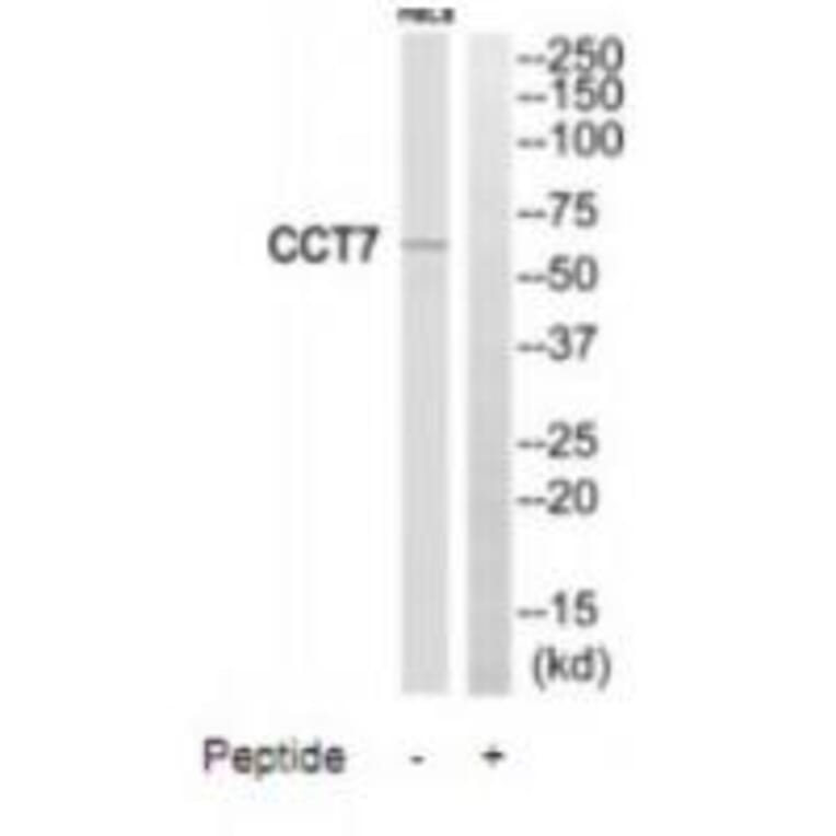 Western blot - CCT7 Antibody from Signalway Antibody (35091) - Antibodies.com