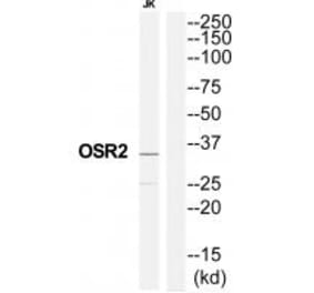 Western blot - OSR2 Antibody from Signalway Antibody (35193) - Antibodies.com