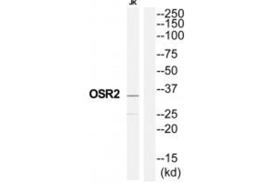 Western blot - OSR2 Antibody from Signalway Antibody (35193) - Antibodies.com