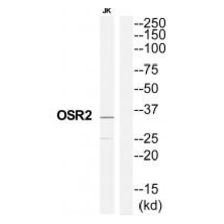 Western blot - OSR2 Antibody from Signalway Antibody (35193) - Antibodies.com