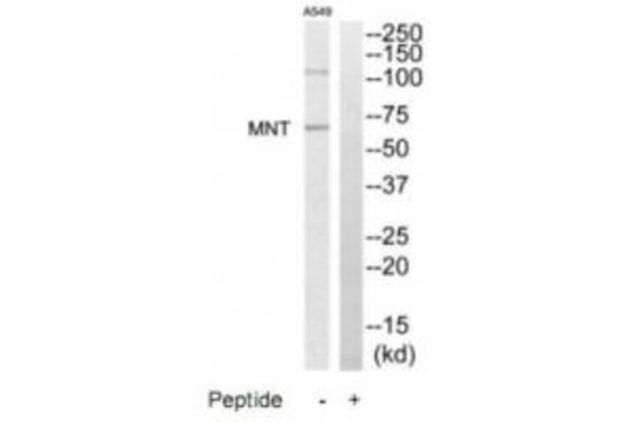 Western blot - MNT Antibody from Signalway Antibody (35195) - Antibodies.com