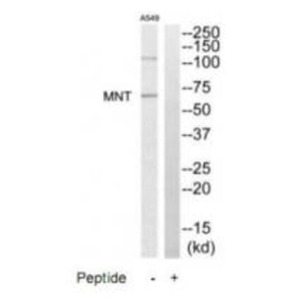 Western blot - MNT Antibody from Signalway Antibody (35195) - Antibodies.com