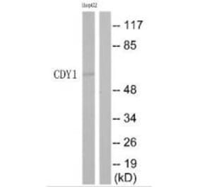 Western blot - CDY1 Antibody from Signalway Antibody (35209) - Antibodies.com