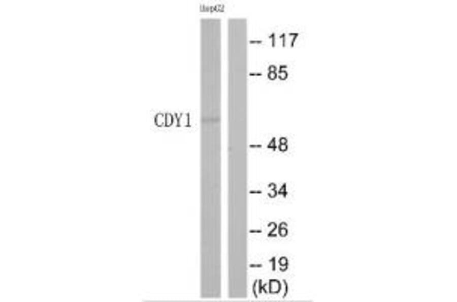 Western blot - CDY1 Antibody from Signalway Antibody (35209) - Antibodies.com