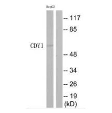 Western blot - CDY1 Antibody from Signalway Antibody (35209) - Antibodies.com