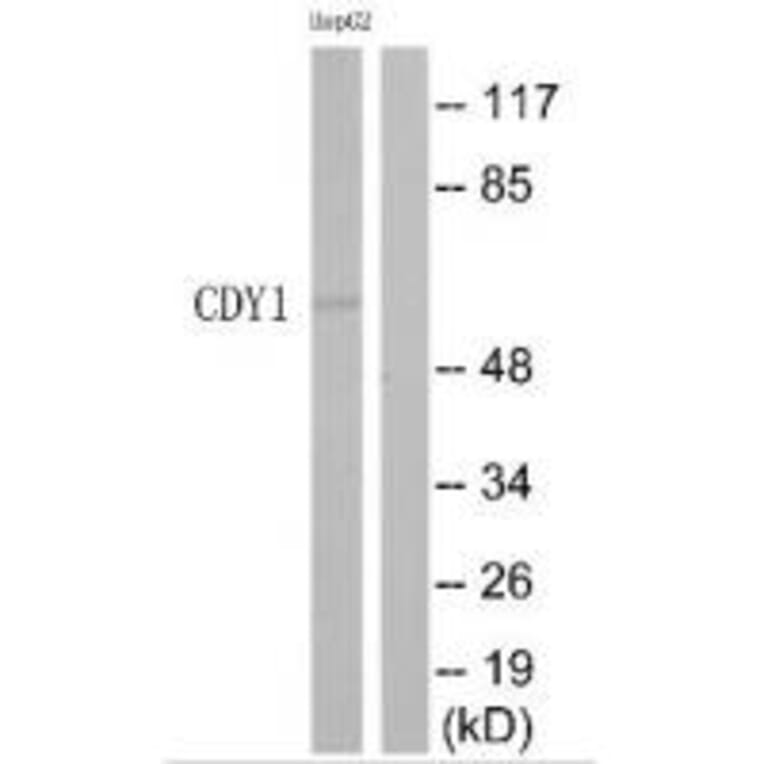 Western blot - CDY1 Antibody from Signalway Antibody (35209) - Antibodies.com