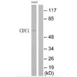 Western blot - CDY1 Antibody from Signalway Antibody (35209) - Antibodies.com