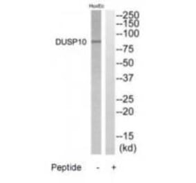 Western blot - DGKB Antibody from Signalway Antibody (35211) - Antibodies.com