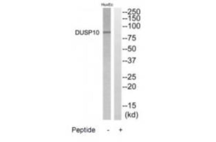 Western blot - DGKB Antibody from Signalway Antibody (35211) - Antibodies.com