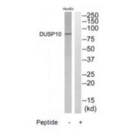 Western blot - DGKB Antibody from Signalway Antibody (35211) - Antibodies.com