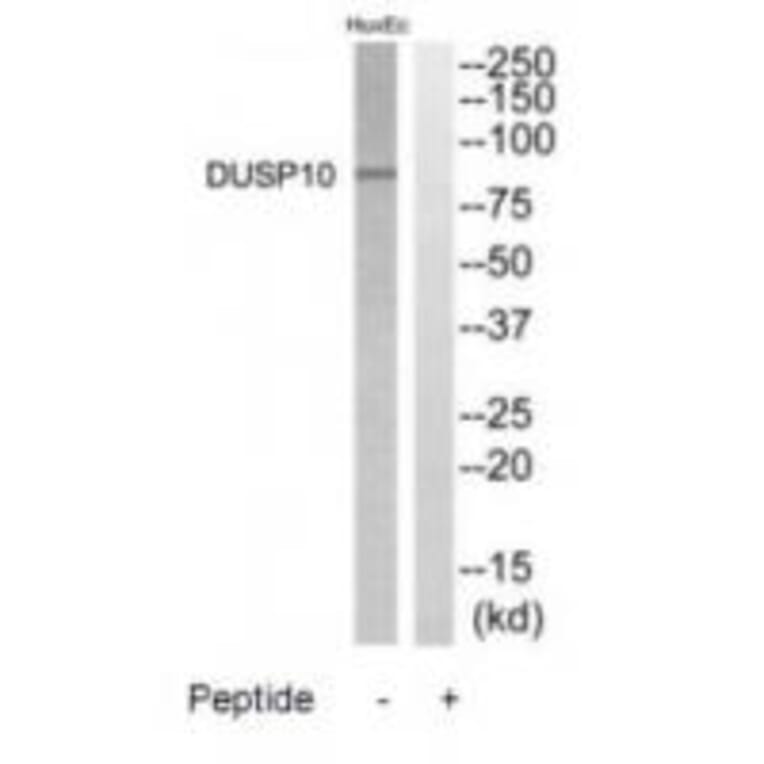 Western blot - DGKB Antibody from Signalway Antibody (35211) - Antibodies.com