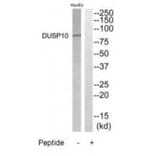 Western blot - DGKB Antibody from Signalway Antibody (35211) - Antibodies.com