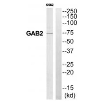 Western blot - GAB2 Antibody from Signalway Antibody (35218) - Antibodies.com