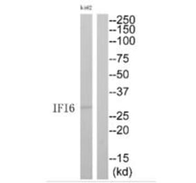 Western blot - IFI6 Antibody from Signalway Antibody (35228) - Antibodies.com