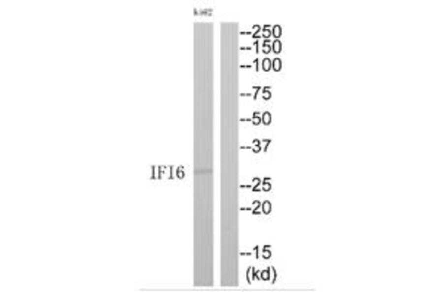 Western blot - IFI6 Antibody from Signalway Antibody (35228) - Antibodies.com