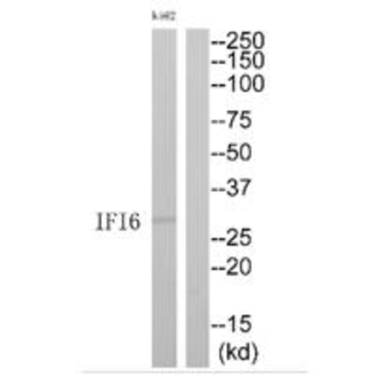 Western blot - IFI6 Antibody from Signalway Antibody (35228) - Antibodies.com