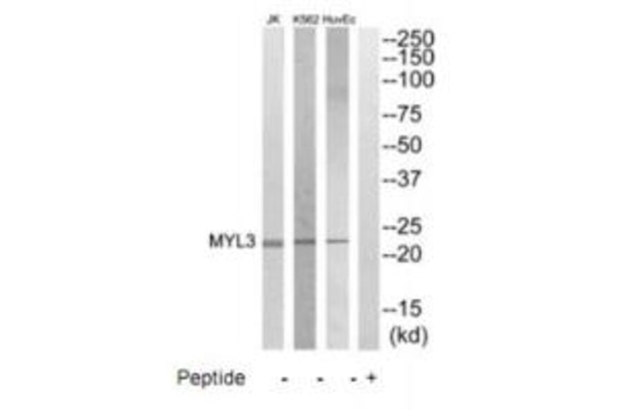 Western blot - MYL3 Antibody from Signalway Antibody (35231) - Antibodies.com