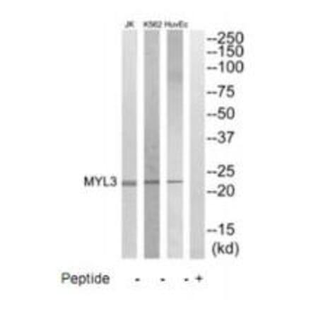 Western blot - MYL3 Antibody from Signalway Antibody (35231) - Antibodies.com