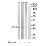 Western blot - MYL3 Antibody from Signalway Antibody (35231) - Antibodies.com