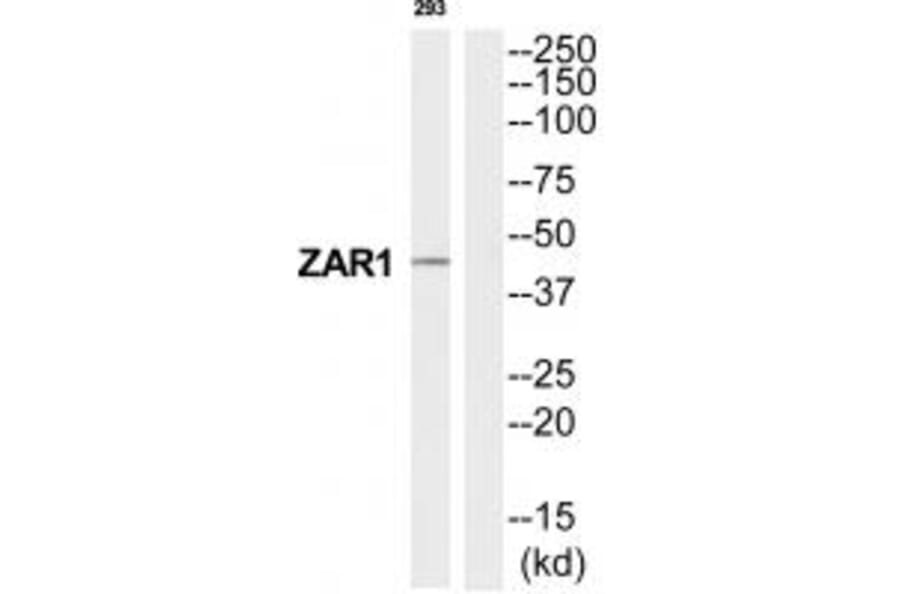 Western blot - ZAR1 Antibody from Signalway Antibody (35241) - Antibodies.com