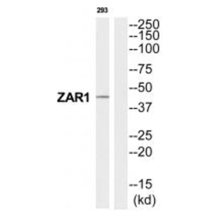 Western blot - ZAR1 Antibody from Signalway Antibody (35241) - Antibodies.com