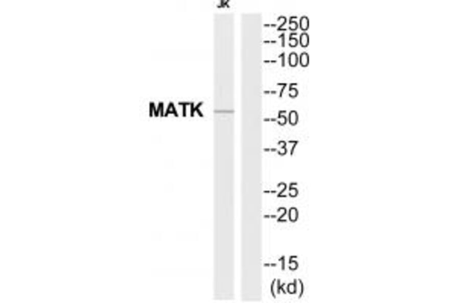 Western blot - MATK Antibody from Signalway Antibody (35281) - Antibodies.com