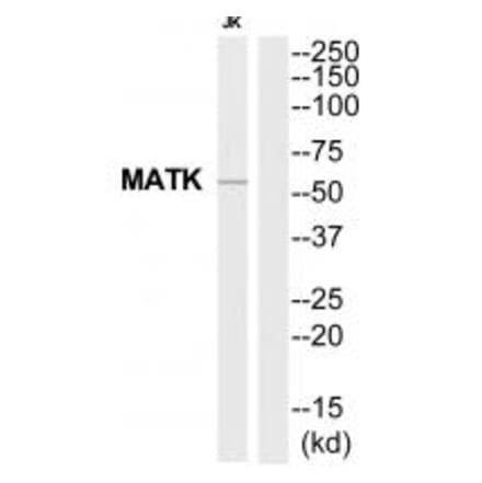 Western blot - MATK Antibody from Signalway Antibody (35281) - Antibodies.com