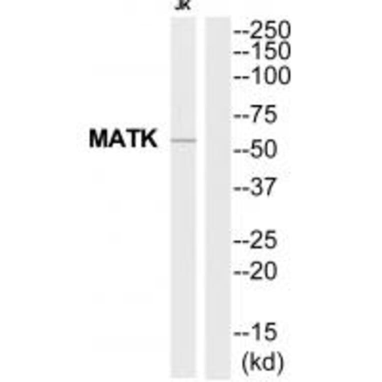 Western blot - MATK Antibody from Signalway Antibody (35281) - Antibodies.com