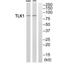 Western blot - TLK1 Antibody from Signalway Antibody (35297) - Antibodies.com