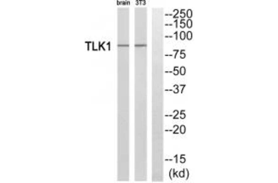 Western blot - TLK1 Antibody from Signalway Antibody (35297) - Antibodies.com