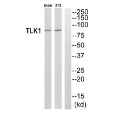 Western blot - TLK1 Antibody from Signalway Antibody (35297) - Antibodies.com