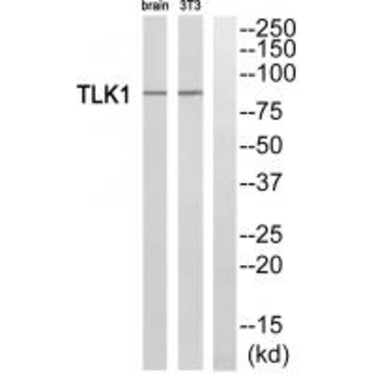Western blot - TLK1 Antibody from Signalway Antibody (35297) - Antibodies.com